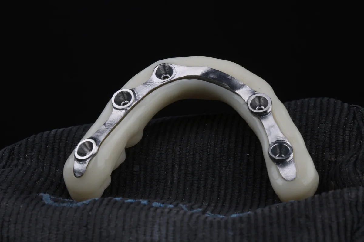 Prótese protocolo vista de cima, com os pontos de fixação nos implantes