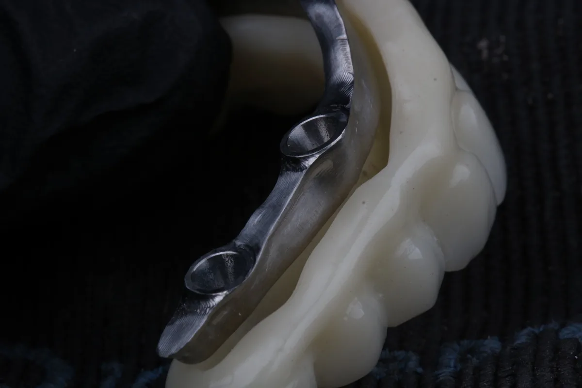 Estrutura metálica de prótese protocolo em detalhe